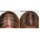 HairMax LaserBand 82 - ComfortFlex LASER THERAPY FOR HAIR REGROWTH, rose gold (16970-rose-gold)