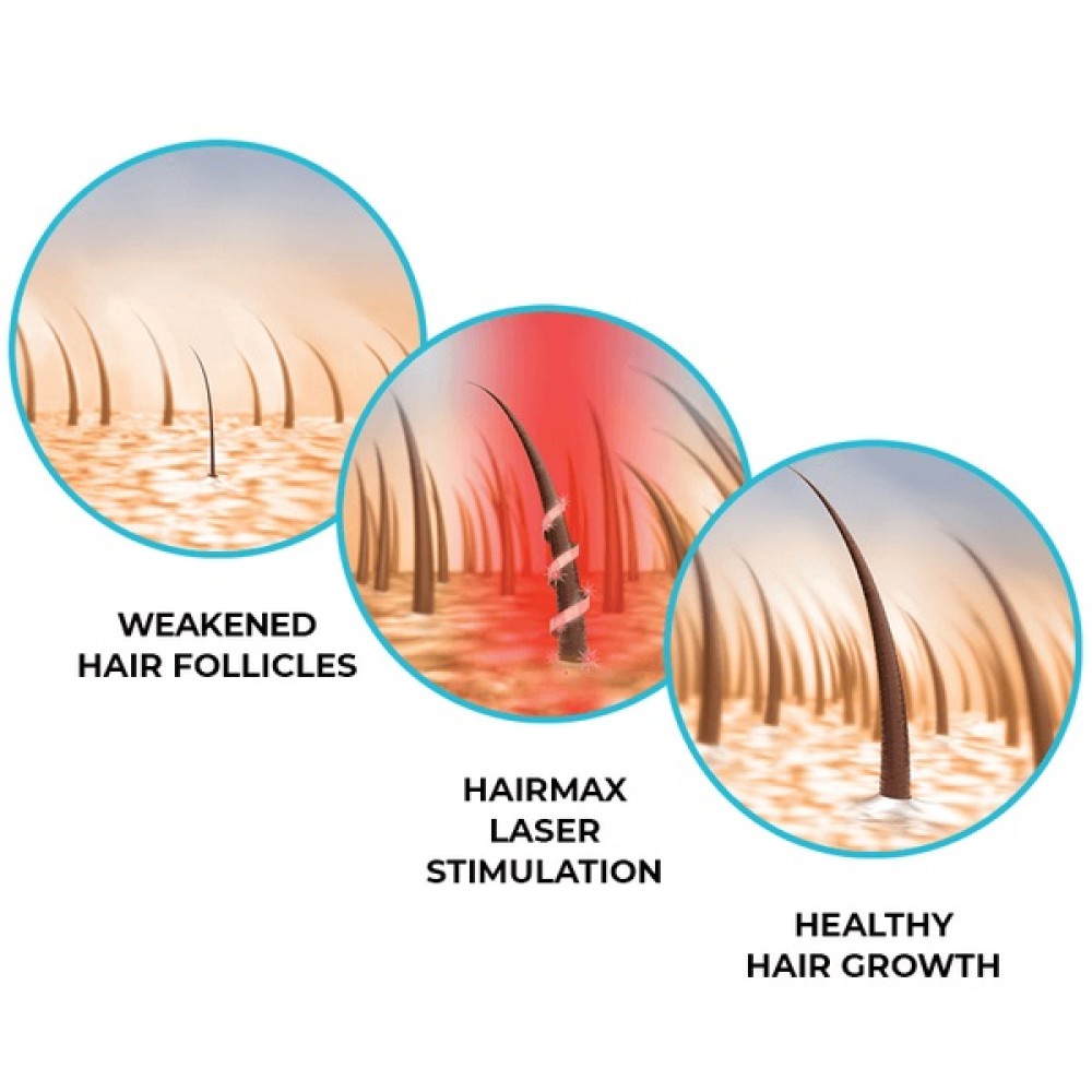 HairMax LaserBand 41 - ComfortFlex LASER THERAPY FOR HAIR REGROWTH (16960)