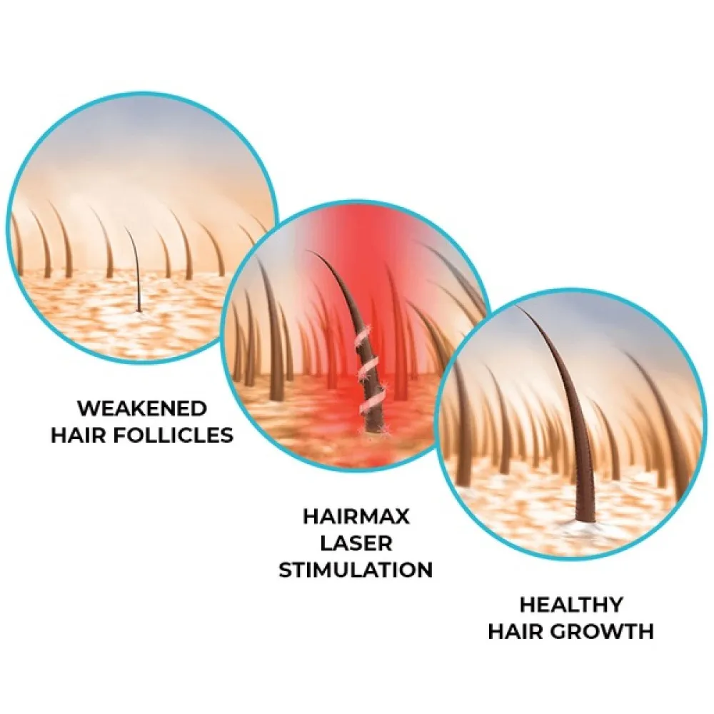 HairMax LaserBand 41 - ComfortFlex LASER THERAPY FOR HAIR REGROWTH