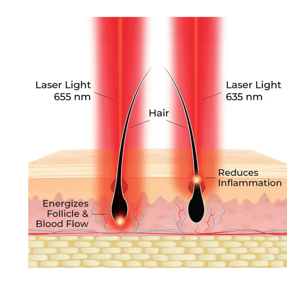 HairMax ACTONIS™ 18 Dual-Action LaserComb