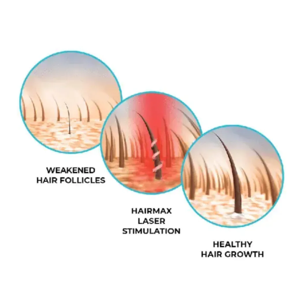 HairMax LaserCap 272 PowerFlex – Laser Hair Growth Cap
