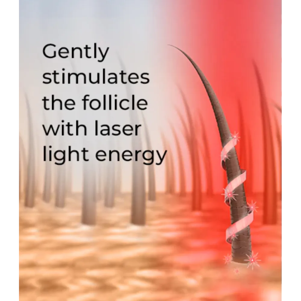 HairMax LaserBand 82 - ComfortFlex LASER THERAPY FOR HAIR REGROWTH, rose gold